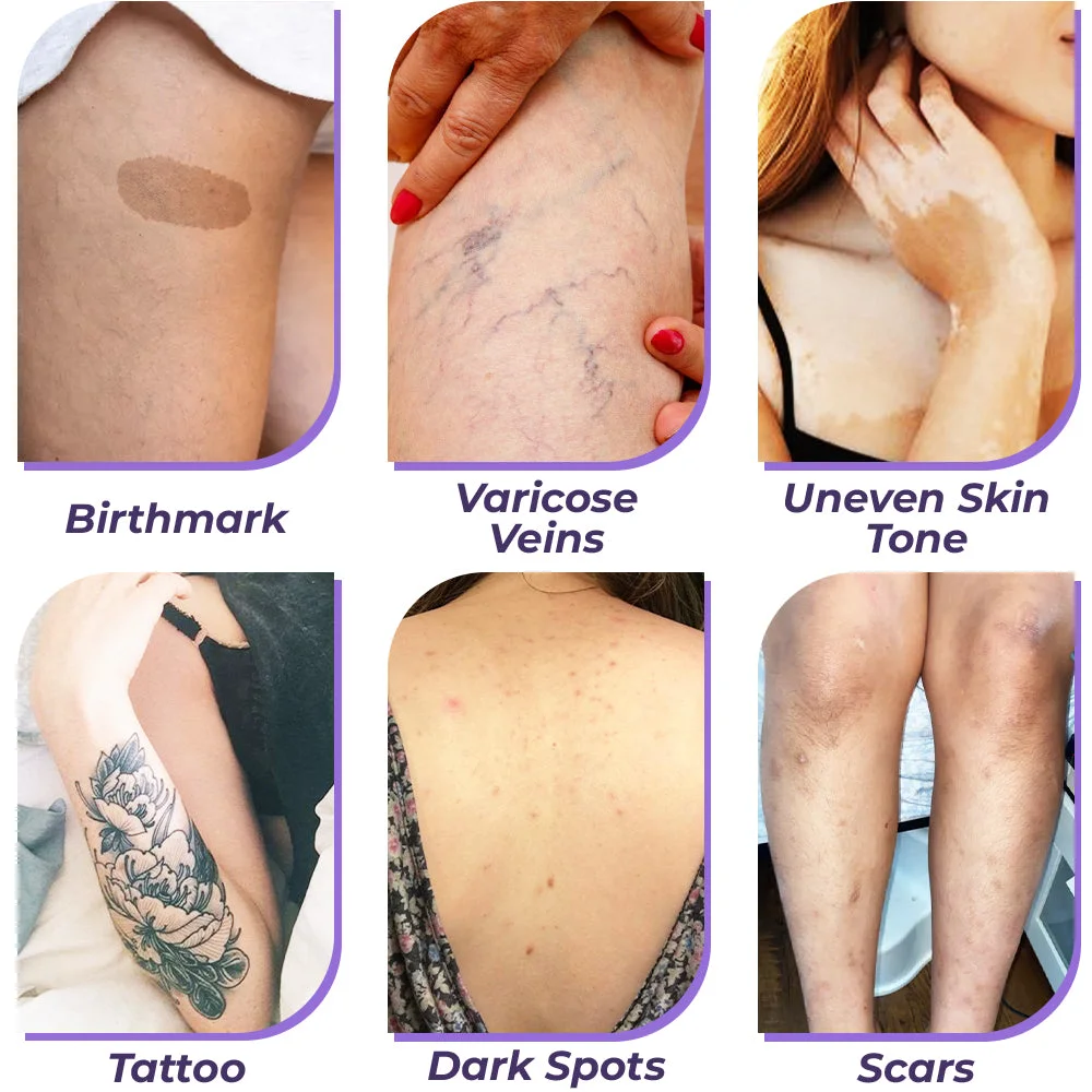 💜Limited-time 50% off💜✨Body Coverage Perfector – Waterproof, Lightweight & Flawless Body Makeup