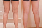 💜Limited-time 50% off💜✨Body Coverage Perfector – Waterproof, Lightweight & Flawless Body Makeup