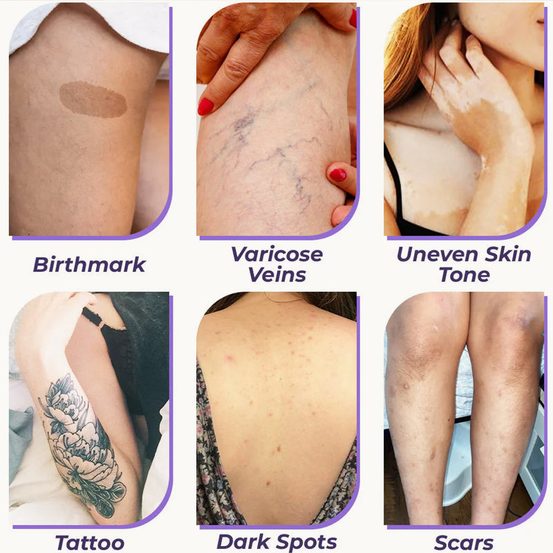 💜Limited-time 50% off💜✨Body Coverage Perfector – Waterproof, Lightweight & Flawless Body Makeup