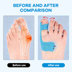 📢📢LAST DAY SALE 50% OFF🦶Pre-cut Bunion Corrector Kinesiology Tape