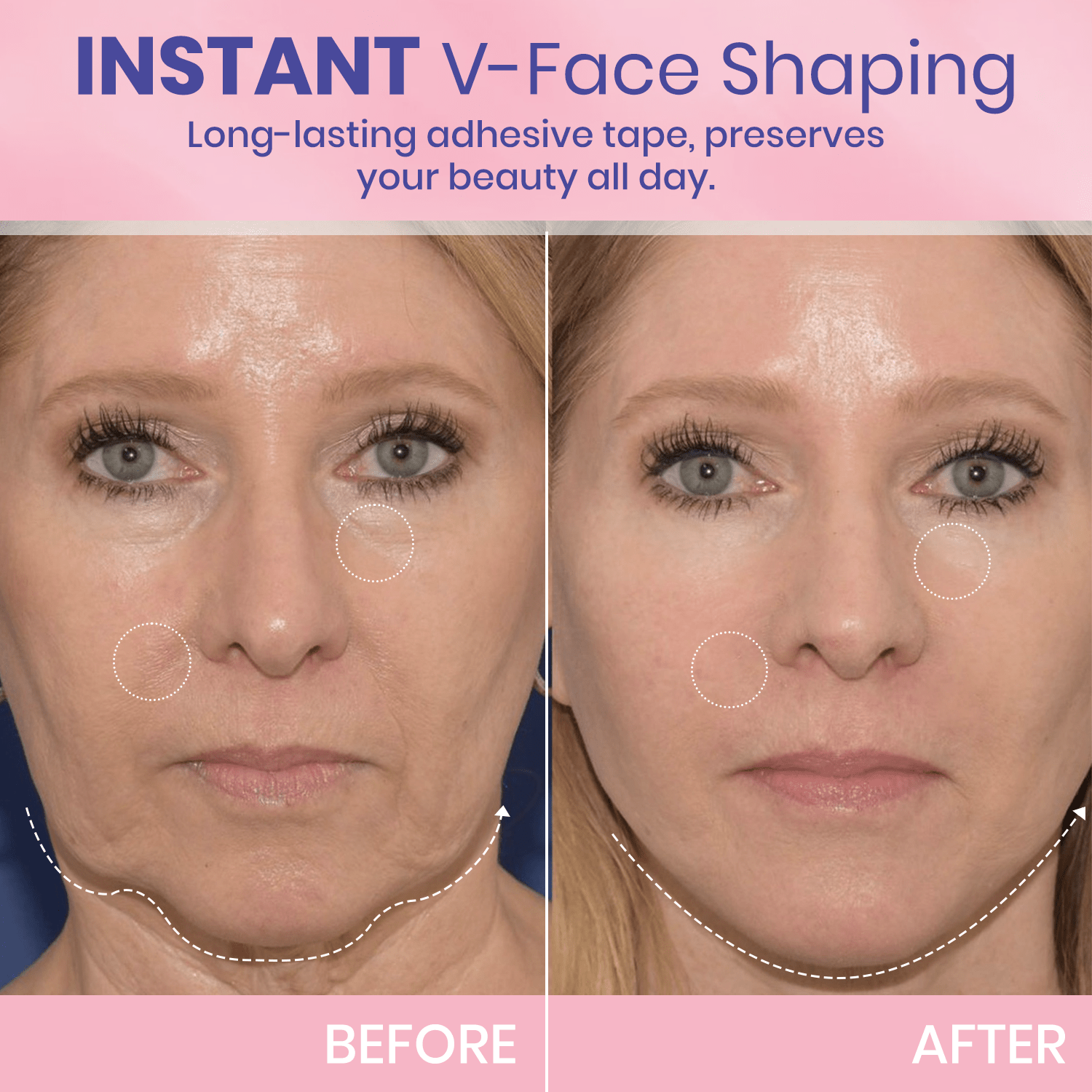 V-Face 👑 Invisible lifting tape